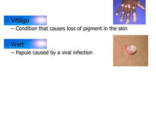 – Vitiligo 
– Condition that causes loss of pigment in the skin 
– Wart 
– Papule caused by a viral infection 
 