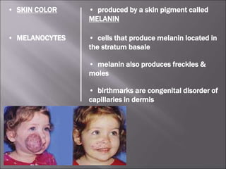 • SKIN COLOR • produced by a skin pigment called
MELANIN
• MELANOCYTES • cells that produce melanin located in
the stratum basale
• melanin also produces freckles &
moles
• birthmarks are congenital disorder of
capillaries in dermis
 