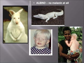 • ALBINO – no melanin at all
 