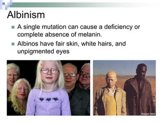 Albinism
 A single mutation can cause a deficiency or
complete absence of melanin.
 Albinos have fair skin, white hairs, and
unpigmented eyes
 