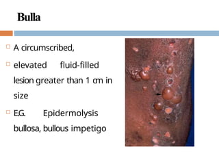 Bulla Photo Nursing care for Integumentary System (Skin).pptx