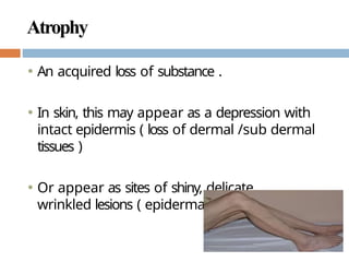 Nursing care for Integumentary System (Skin).pptx