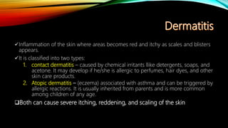 Inflammation of the skin where areas becomes red and itchy as scales and blisters
appears.
It is classified into two types:
1. contact dermatitis – caused by chemical irritants llike detergents, soaps, and
acetone. It may develop if he/she is allergic to perfumes, hair dyes, and other
skin care products.
2. Atopic dermatitis – (eczema) associated with asthma and can be triggered by
allergic reactions. It is usually inherited from parents and is more common
among children of any age.
Both can cause severe itching, reddening, and scaling of the skin
 