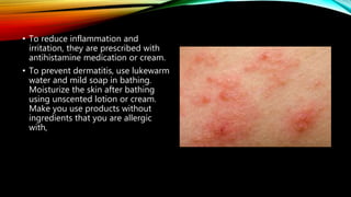 • To reduce inflammation and
irritation, they are prescribed with
antihistamine medication or cream.
• To prevent dermatitis, use lukewarm
water and mild soap in bathing.
Moisturize the skin after bathing
using unscented lotion or cream.
Make you use products without
ingredients that you are allergic
with,
 