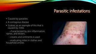 • Caused by parasites
• A contagious disease
• Scabies as an example of this that is
caused by mites.
- characterized by skin inflammation,
rashes, and blisters.
- creams and ointments is used
- eradicating mites in clothes and
household articles
 