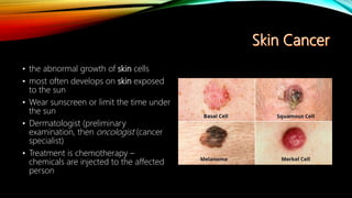 • the abnormal growth of skin cells
• most often develops on skin exposed
to the sun
• Wear sunscreen or limit the time under
the sun
• Dermatologist (preliminary
examination, then oncologist (cancer
specialist)
• Treatment is chemotherapy –
chemicals are injected to the affected
person
 