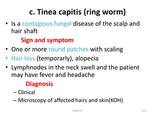 c. Tinea capitis (ring worm) 
• Is a contagious fungal disease of the scalp and 
hair shaft 
Sign and symptom 
• One or more round patches with scaling 
• Hair loss (temporarly), alopecia 
• Lymphnodes in the neck swell and the patient 
may have fever and headache 
Diagnosis 
– Clinical 
– Microscopy of affected hairs and skin(KOH) 
HA(MSN) 102 
 