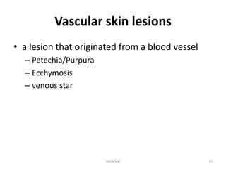 Vascular skin lesions 
• a lesion that originated from a blood vessel 
– Petechia/Purpura 
– Ecchymosis 
– venous star 
HA(MSN) 15 
 