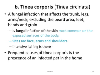 b. Tinea corporis (Tinea circinata) 
• A fungal infection that affects the trunk, legs, 
arms/neck, excluding the beard area, feet, 
hands and groin 
– Is fungal infection of the skin most common on the 
exposed surfaces of the body. 
– Sites are face, arms and shoulders. 
– Intensive itching is there 
• Frequent causes of tinea corporis is the 
prescence of an infected pet in the home 
HA(MSN) 99 
 