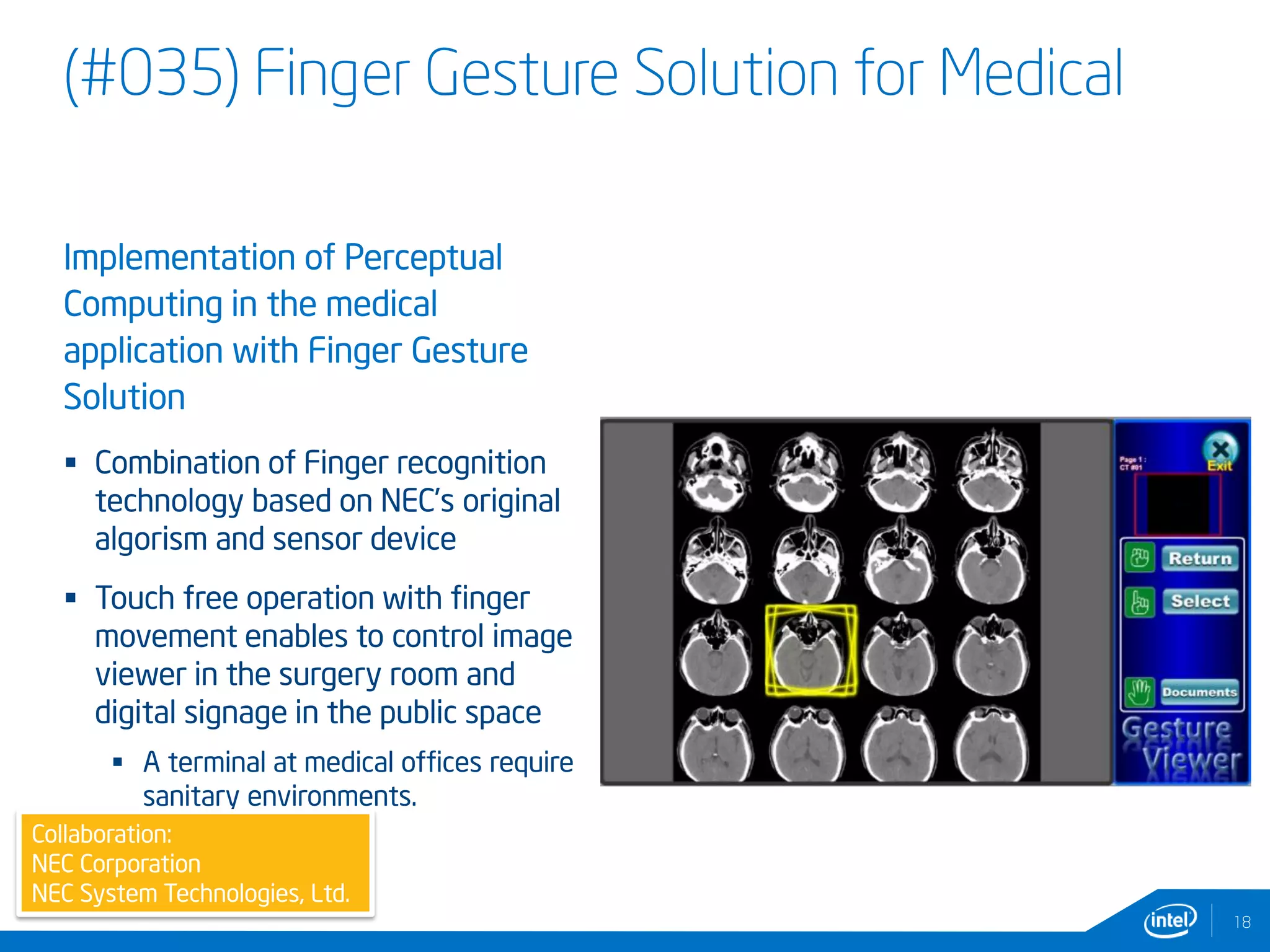(#035) Finger Gesture Solution for Medical
Implementation of Perceptual
Computing in the medical
application with Finger Gesture
Solution
 Combination of Finger recognition
technology based on NEC’s original
algorism and sensor device
 Touch free operation with finger
movement enables to control image
viewer in the surgery room and
digital signage in the public space
 A terminal at medical offices require
sanitary environments.
18
Collaboration:
NEC Corporation
NEC System Technologies, Ltd.
 