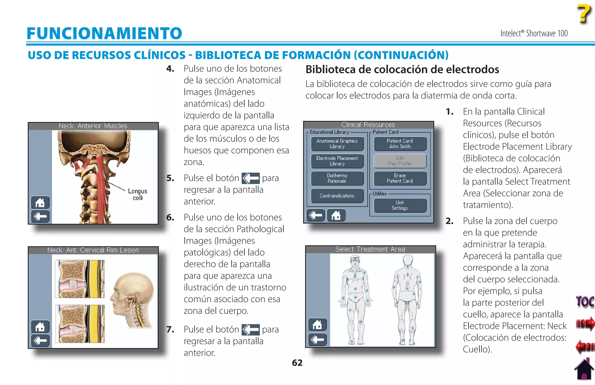 FUNCIONAMIENTO                                                                                                   Intelect® Shortwave 100

USO DE RECURSOS CLÍNICOS  BIBLIOTECA DE FORMACIÓN CONTINUACIÓN
                     4. Pulse uno de los botones Biblioteca de colocación de electrodos
                             de la sección Anatomical           La biblioteca de colocación de electrodos sirve como guía para
                             Images (Imágenes                   colocar los electrodos para la diatermia de onda corta.
                             anatómicas) del lado
                             izquierdo de la pantalla                                              1. En la pantalla Clinical
                             para que aparezca una lista                                              Resources (Recursos
                             de los músculos o de los                                                 clínicos), pulse el botón
                             huesos que componen esa                                                  Electrode Placement Library
                             zona.                                                                    (Biblioteca de colocación
                                                                                                      de electrodos). Aparecerá
                         5
                         5. Pulse el botón        para                                                la pantalla Select Treatment
                            regresar a la pantalla                                                    Area (Seleccionar zona de
                            anterior.                                                                 tratamiento).
                         6. Pulse uno de los botones
                         6                                                                         2
                                                                                                   2. Pulse la zona del cuerpo
                            de la sección Pathological                                                en la que pretende
                            Images (Imágenes                                                          administrar la terapia.
                            patológicas) del lado                                                     Aparecerá la pantalla que
                            derecho de la pantalla                                                    corresponde a la zona
                            para que aparezca una                                                     del cuerpo seleccionada.
                            ilustración de un trastorno                                               Por ejemplo, si pulsa
                            común asociado con esa                                                    la parte posterior del
                            zona del cuerpo.                                                          cuello, aparece la pantalla
                         7. Pulse el botón
                         7                        para                                                Electrode Placement: Neck
                            regresar a la pantalla                                                    (Colocación de electrodos:
                            anterior.                                                                 Cuello).
                                                           62
 