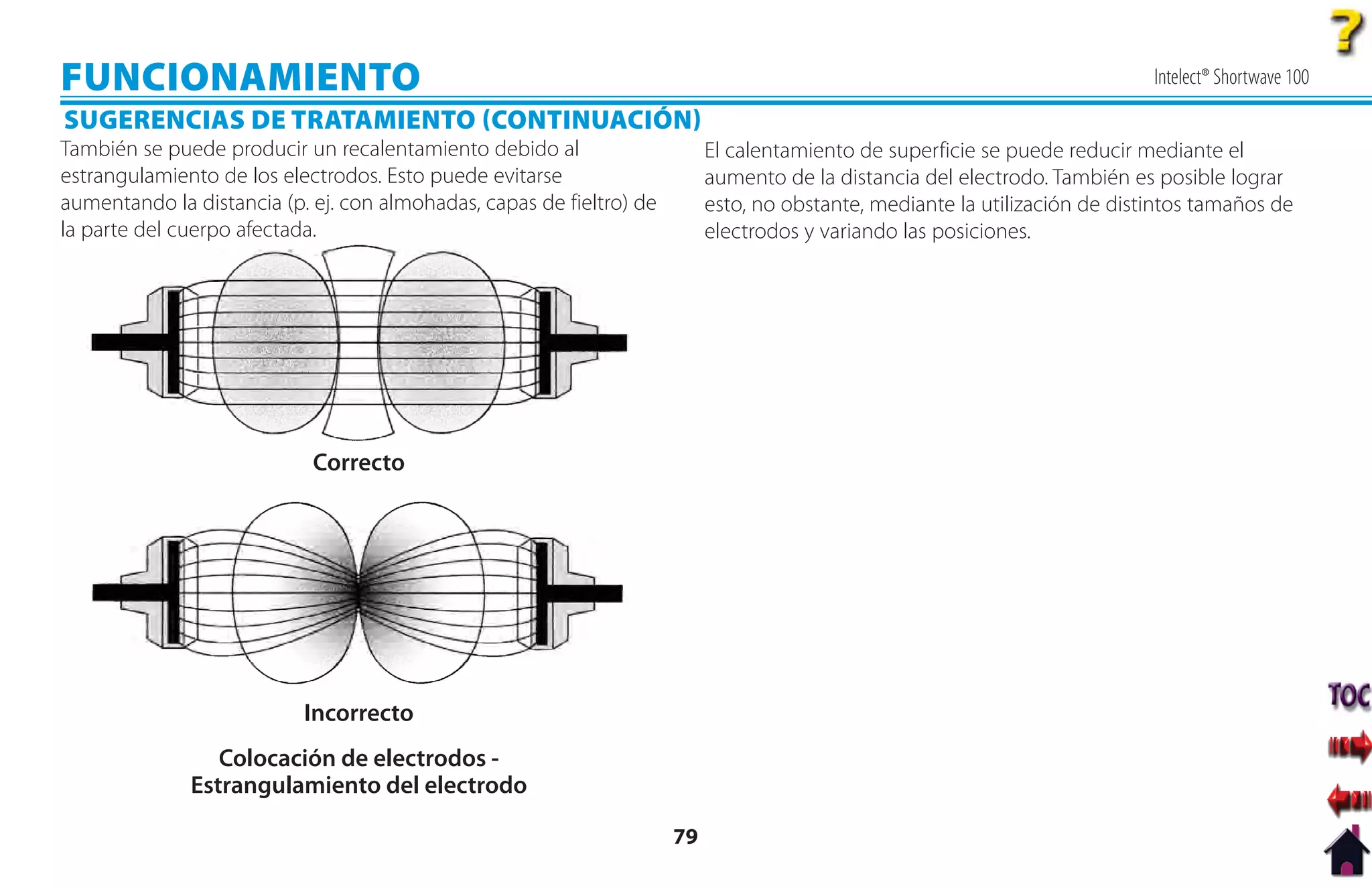 FUNCIONAMIENTO                                                                                                               Intelect® Shortwave 100
SUGERENCIAS DE TRATAMIENTO CONTINUACIÓN
También se puede producir un recalentamiento debido al                     El calentamiento de superficie se puede reducir mediante el
estrangulamiento de los electrodos. Esto puede evitarse                    aumento de la distancia del electrodo. También es posible lograr
aumentando la distancia (p. ej. con almohadas, capas de fieltro) de        esto, no obstante, mediante la utilización de distintos tamaños de
la parte del cuerpo afectada.                                              electrodos y variando las posiciones.




                            Correcto




                           Incorrecto
                 Colocación de electrodos -
              Estrangulamiento del electrodo

                                                                      79
 