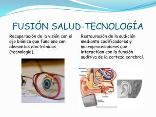 FUSIÓN SALUD-TECNOLOGÍA
Recuperación de la visión con el   Restauración de la audición
ojo biónico que funciona con       mediante codificadores y
elementos electrónicos             microprocesadores que
(tecnología).                      interactúan con la función
                                   auditiva de la corteza cerebral.
 