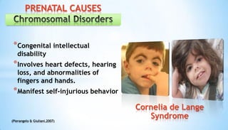 *Congenital intellectual
disability
*Involves heart defects, hearing
loss, and abnormalities of
fingers and hands.
*Manifest self-injurious behavior
(Pierangelo & Giuliani,2007)
PRENATAL CAUSES
Cornelia de Lange
Syndrome
 