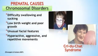 *Difficulty swallowing and
sucking
*Low birth weight and poor
growth
*Unusual facial features
*Hyperactive, aggressive, and
repetitive movements
(Pierangelo & Giuliani,2007)
PRENATAL CAUSES
Cri-du-Chat
Syndrome
 