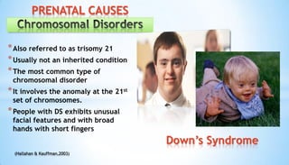 *Also referred to as trisomy 21
*Usually not an inherited condition
*The most common type of
chromosomal disorder
*It involves the anomaly at the 21st
set of chromosomes.
*People with DS exhibits unusual
facial features and with broad
hands with short fingers
(Hallahan & Kauffman,2003)
PRENATAL CAUSES
Down’s Syndrome
 