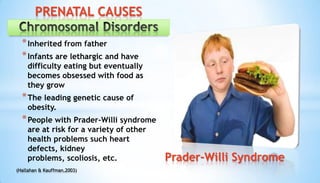 *Inherited from father
*Infants are lethargic and have
difficulty eating but eventually
becomes obsessed with food as
they grow
*The leading genetic cause of
obesity.
*People with Prader-Willi syndrome
are at risk for a variety of other
health problems such heart
defects, kidney
problems, scoliosis, etc. Prader-Willi Syndrome
PRENATAL CAUSES
(Hallahan & Kauffman,2003)
 
