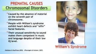*Caused by the absence of material
on the seventh pair of
chromosome.
*People with William’s syndrome
exhibit heart defects and “elfin”
facial features.
*Their unusual sensitivity to sound
makes them competent in music
and language despite of their low
IQ level.
William’s Syndrome
PRENATAL CAUSES
(Hallahan & Kauffman,2003) (Pierangelo & Giuliani, 2007)
 