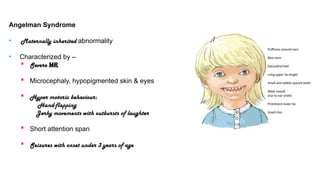 Angelman Syndrome
• Maternally inherited abnormality
• Characterized by –
 Severe MR
 Microcephaly, hypopigmented skin & eyes
 Hyper motoric behaviour:
Hand-flapping
Jerky movements with outbursts of laughter
 Short attention span
 Seizures with onset under 3 years of age
Puffiness around eyes
Blue eyes
Epicanthal fold
Long upper lip length
Small and widely spaced teeth
Wide mouth
(ear to ear smile)
Prominent lower lip
Small chin
 