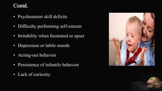Mental Retardation and ADHD | PDF