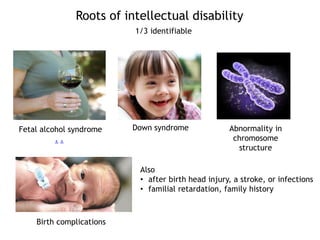 Roots of intellectual disability
Fetal alcohol syndrome
. .
Down syndrome Abnormality in
chromosome
structure
Birth complications
Also
• after birth head injury, a stroke, or infections
• familial retardation, family history
1/3 identifiable
 