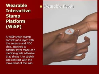 Wearable
Interactive
Stamp
Platform
(WiSP)
 Wearable Patch
A WiSP smart stamp
consists of a layer with
the antenna and NDC
chip, attached to
another layer made of a
medical-grade adhesive
that allows it to stretch
and contract with the
movement of the skin.
 