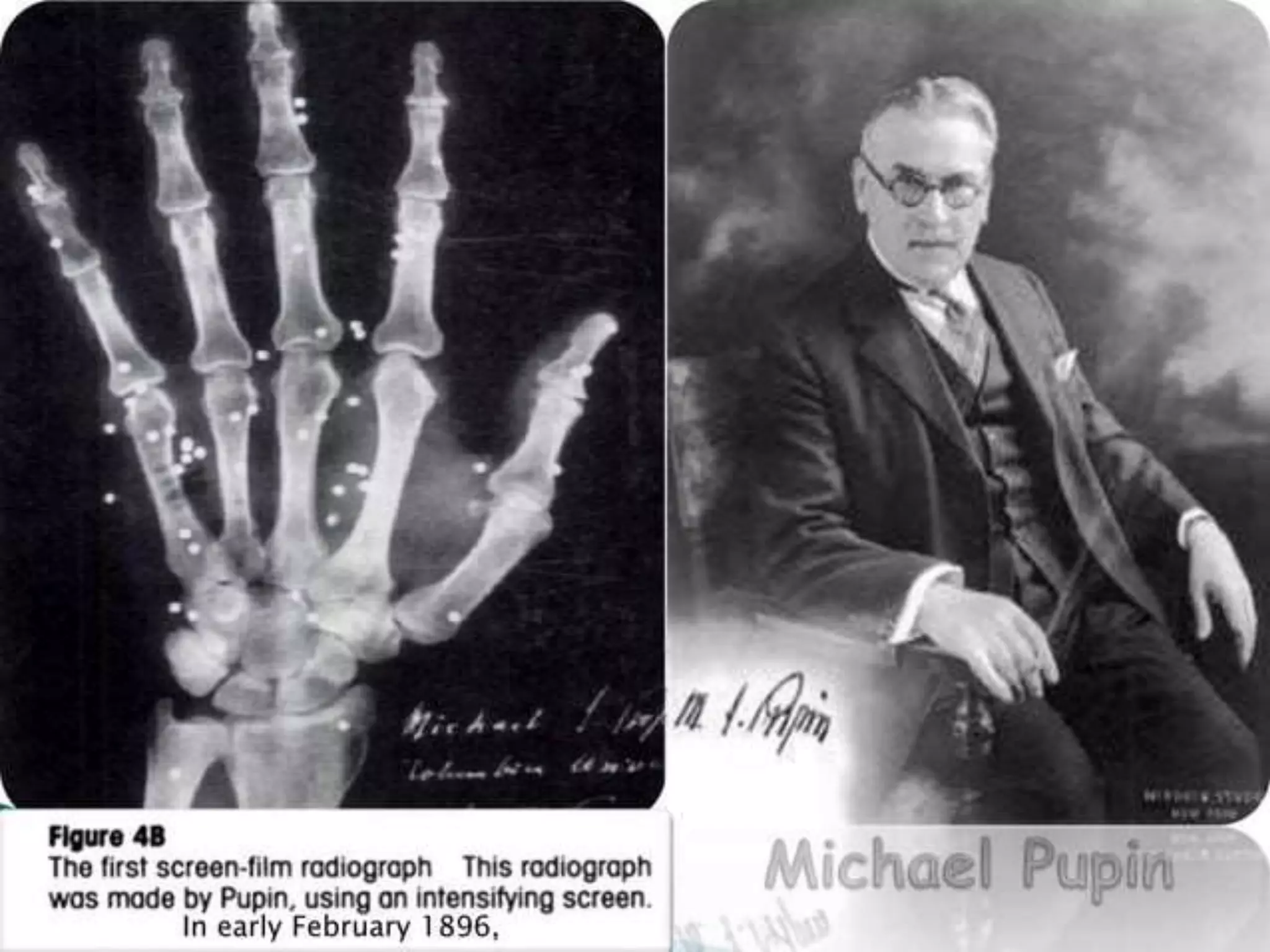 intensifying screen.pptx