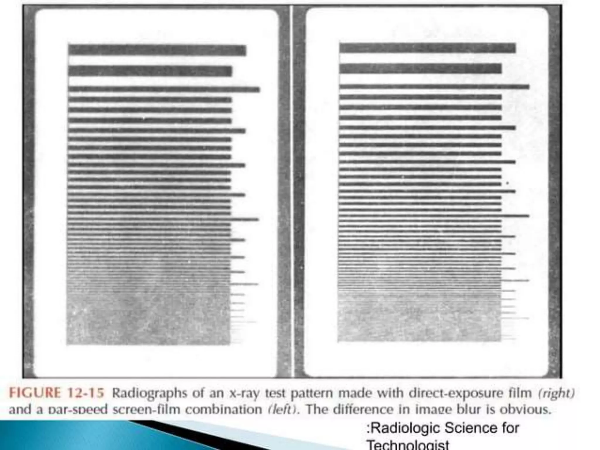 intensifying screen.pptx