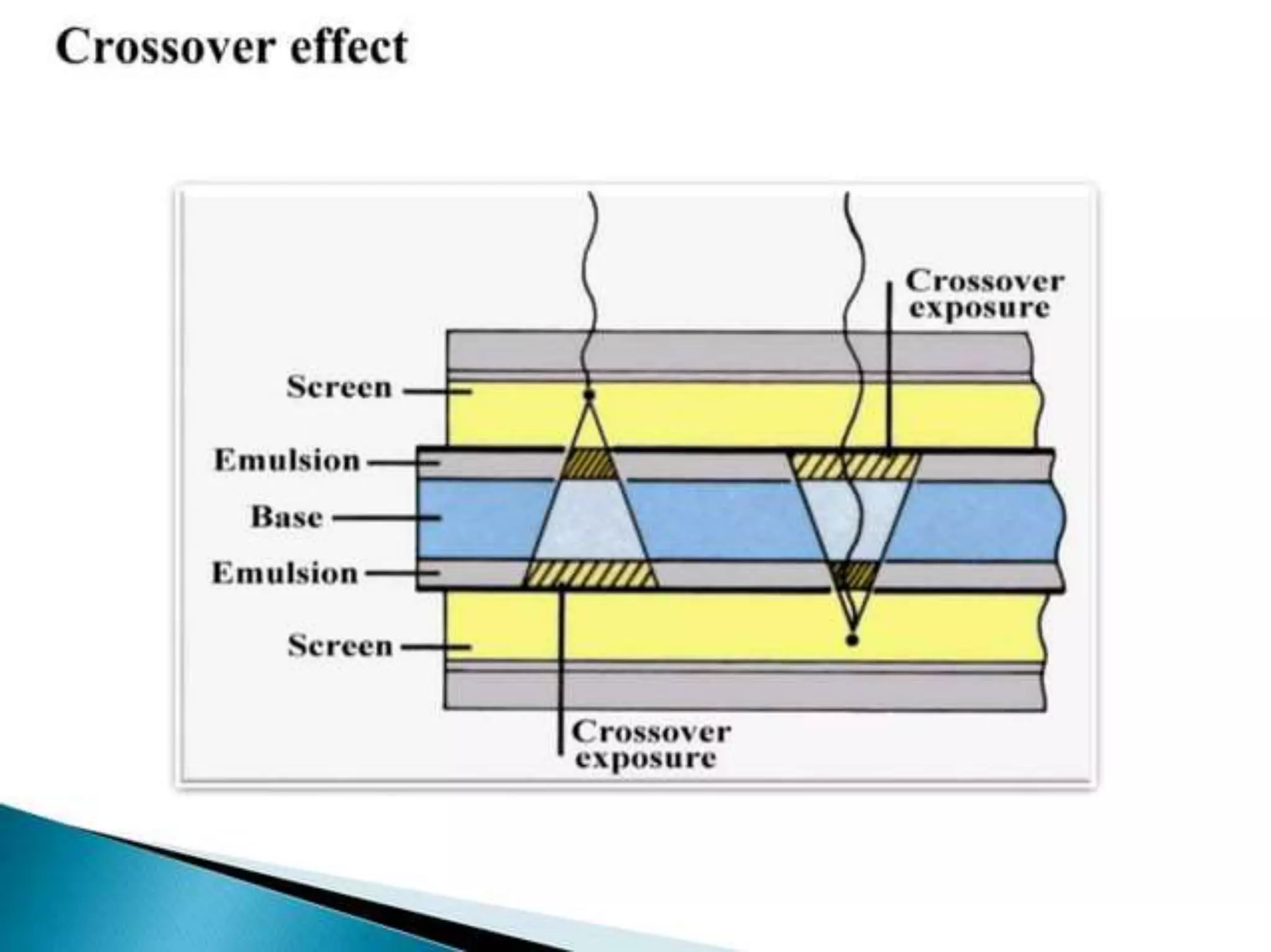 intensifying screen.pptx