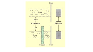 Intensity Screen intensifying screen and its types by T.R.B. | PPTX