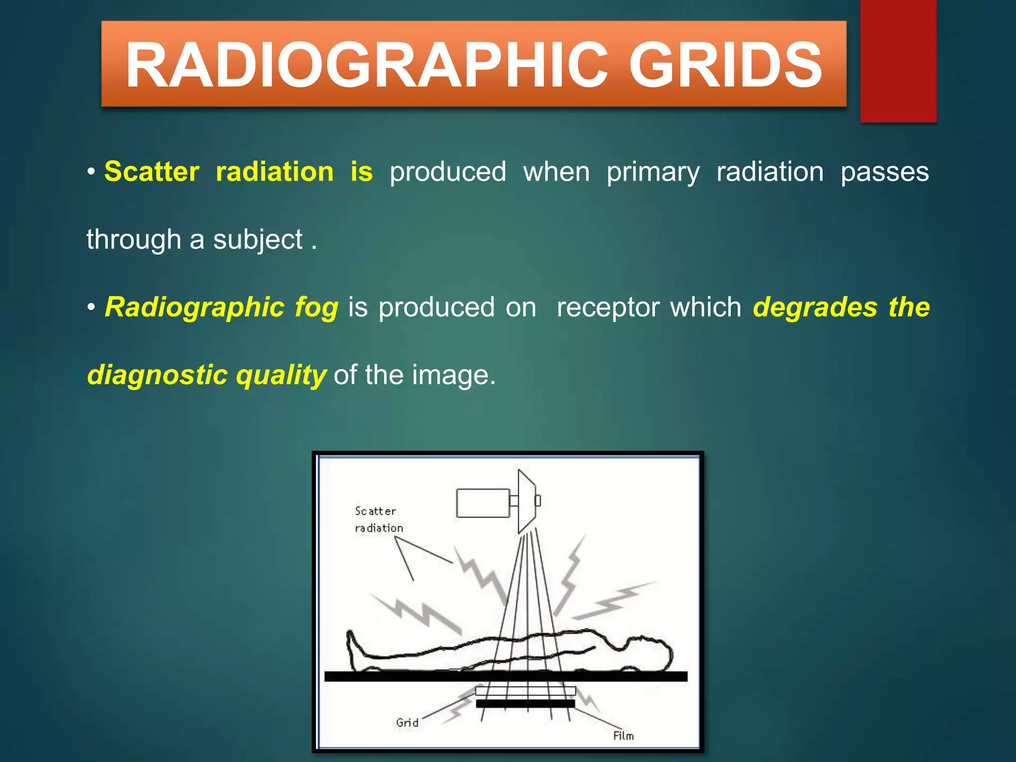 Scadding Radiological Classification intensifying screens and grids.pptx