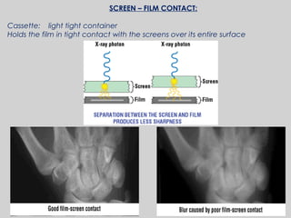 17
SCREEN – FILM CONTACT:
Cassette: light tight container
Holds the film in tight contact with the screens over its entire surface
 