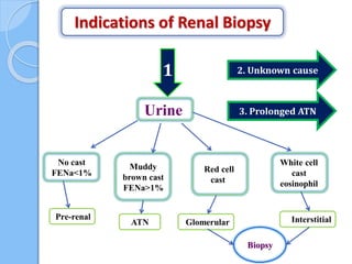 Indications of Renal Biopsy
1
Urine
No cast
FENa<1%
Muddy
brown cast
FENa>1%
Red cell
cast
White cell
cast
eosinophil
Pre-renal
ATN Glomerular Interstitial
Biopsy
2. Unknown cause
3. Prolonged ATN
 