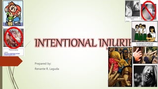 INTENTIONAL INJURIES
Prepared by:
Renante R. Laguda
 
