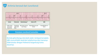 Intepreatasi Gambaran EKG pada Aritmia dan Penatalaksanaan Awal.pptx
