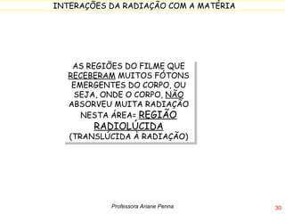 AS REGIÕES DO FILME QUE  RECEBERAM  MUITOS FÓTONS EMERGENTES DO CORPO, OU SEJA, ONDE O CORPO,  NÃO  ABSORVEU MUITA RADIAÇÃO NESTA ÁREA=  REGIÃO RADIOLÚCIDA  (TRANSLÚCIDA À RADIAÇÃO) Professora Ariane Penna 