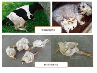 Hipocalcemia
Encefalomacia
 