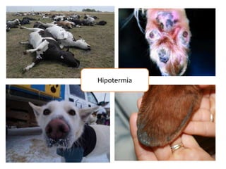 Hipotermia
 