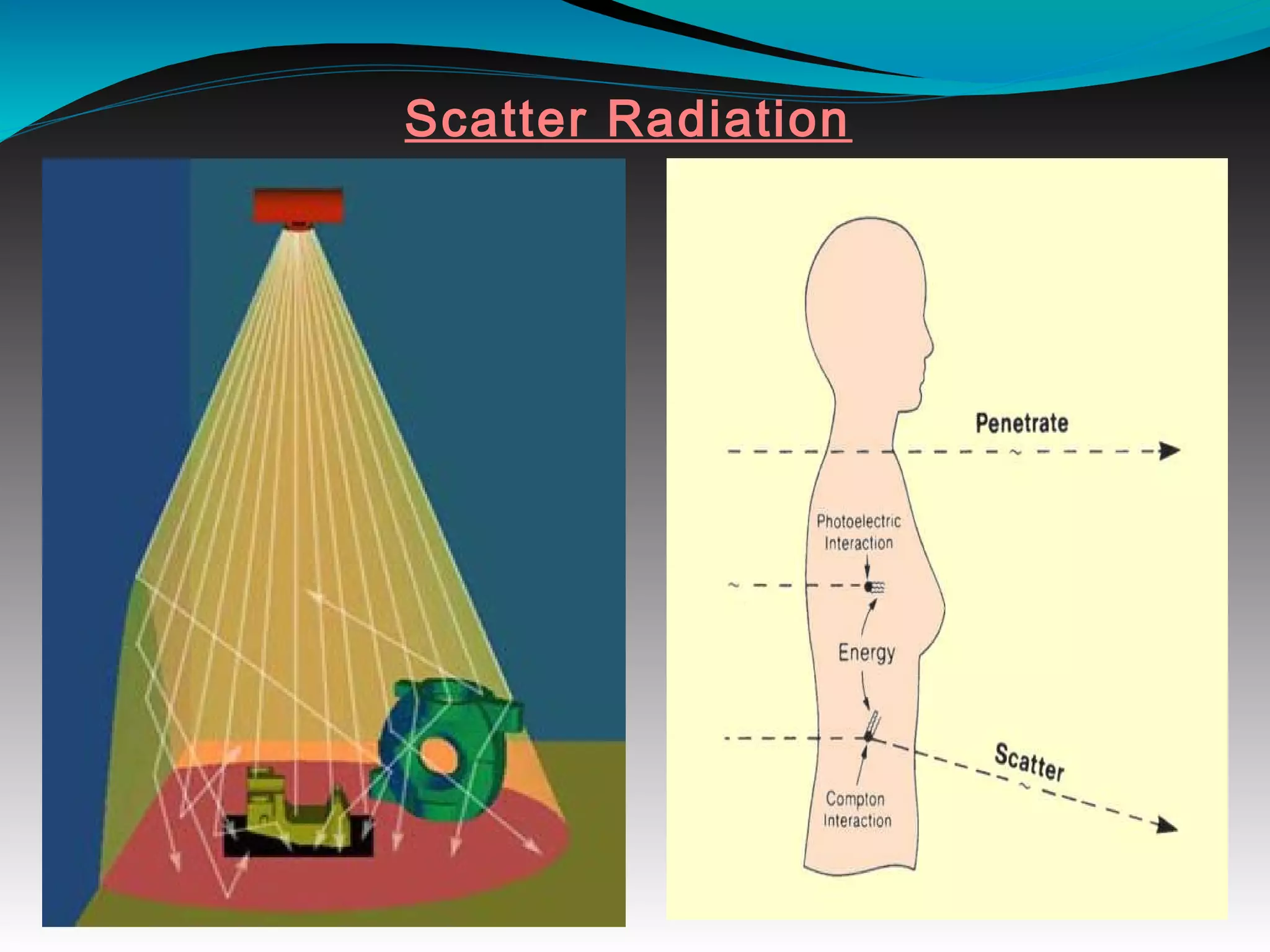 Scatter Radiation
 