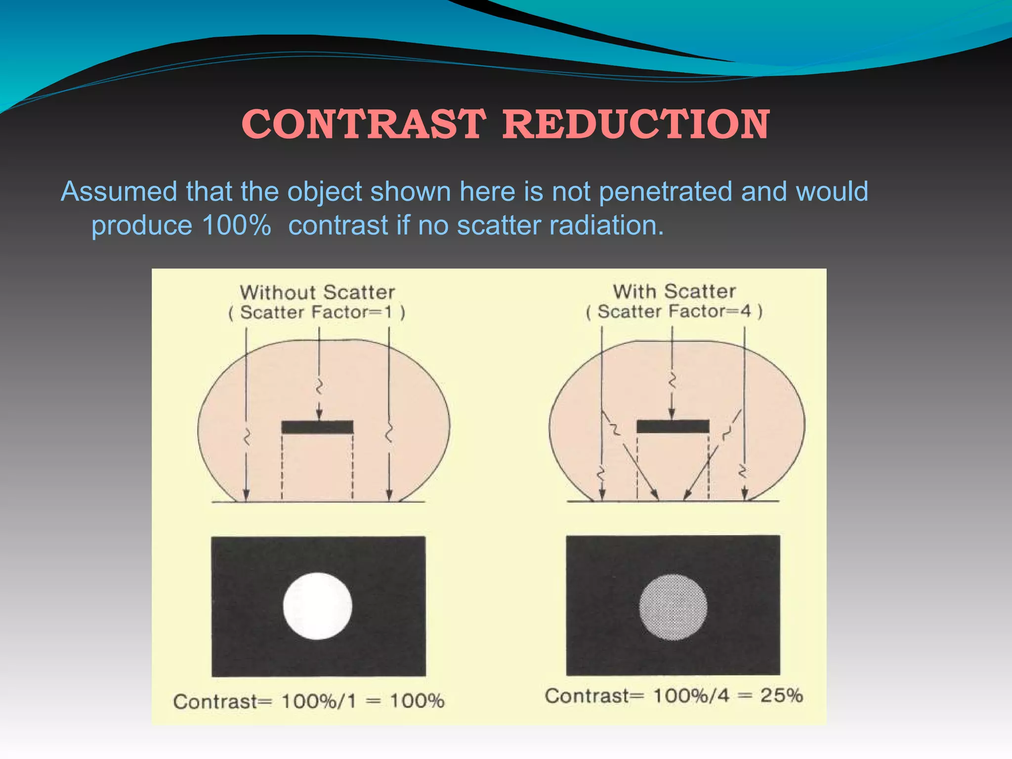 CONTRAST REDUCTION
Assumed that the object shown here is not penetrated and would
produce 100% contrast if no scatter radiation.
 