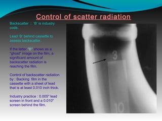 Control of scatter radiation
Backscatter : ‘B’ is industry
code.
Lead ‘B’ behind cassette to
assess backscatter.
If the letter "B" shows as a
"ghost" image on the film, a
significant amount of
backscatter radiation is
reaching the film.
Control of backscatter radiation
by : Backing film in the
cassette with a sheet of lead
that is at least 0.010 inch thick.
Industry practice : 0.005" lead
screen in front and a 0.010"
screen behind the film.
 