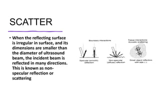 iinteractionsofultrasoundwithmatter.pptx