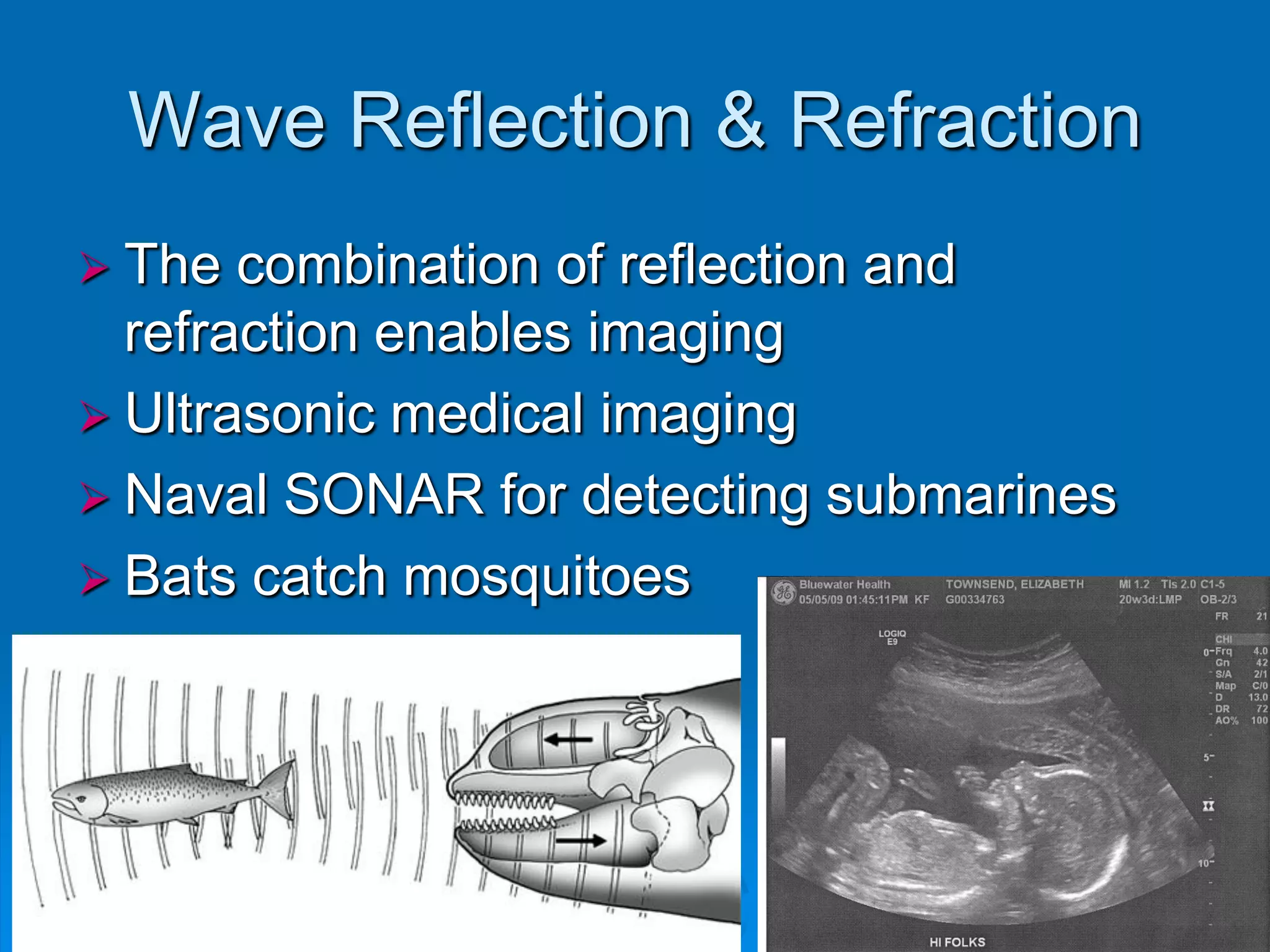 Wave Reflection & Refraction
 The  combination of reflection and
  refraction enables imaging
 Ultrasonic medical imaging
 Naval SONAR for detecting submarines
 Bats catch mosquitoes
 