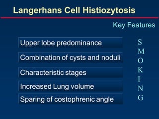 Langerhans Cell Histiozytosis
Key Features
Upper lobe predominance
Combination of cysts and noduli
Characteristic stages
Increased Lung volume
Sparing of costophrenic angle
S
M
O
K
I
N
G
 