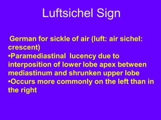 Luftsichel Sign
•German for sickle of air (luft: air sichel:
crescent)
•Paramediastinal lucency due to
interposition of lower lobe apex between
mediastinum and shrunken upper lobe
•Occurs more commonly on the left than in
the right
 