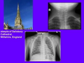 steeple of Salisbury
Cathedral,
Wiltshire, England
 