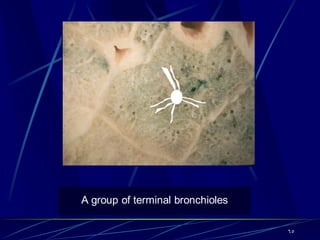 A group of terminal bronchioles
65
 