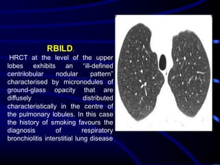 RBILD.
HRCT at the level of the upper
lobes exhibits an “ill-defined
centrilobular nodular pattern”
characterised by micronodules of
ground-glass opacity that are
diffusely distributed
characteristically in the centre of
the pulmonary lobules. In this case
the history of smoking favours the
diagnosis of respiratory
bronchiolitis interstitial lung disease
 