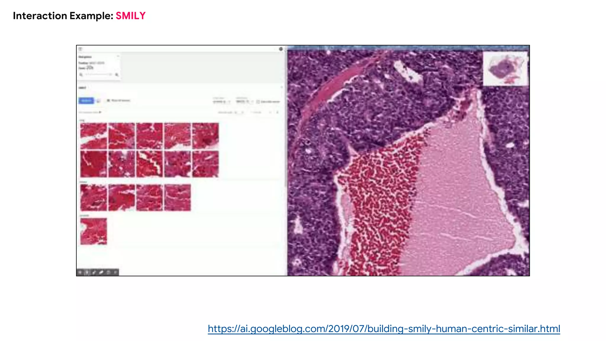 Interaction Example: SMILY
https://ai.googleblog.com/2019/07/building-smily-human-centric-similar.html
 