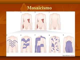Mosaicismo
 